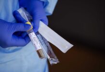 Почна примената на брзите тестови за Ковид-19