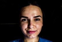 Околу 40 медицински сестри од Клиниката за инфективни болести не им е продолжен договорот за работа