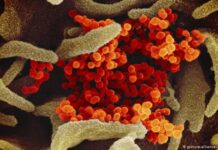 Бројот на заболени од сезонски грип оваа сезона помал за речиси 93 отсто