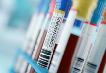 Изминатата недела за 37 % е намален бројот на заразени од Ковид-19