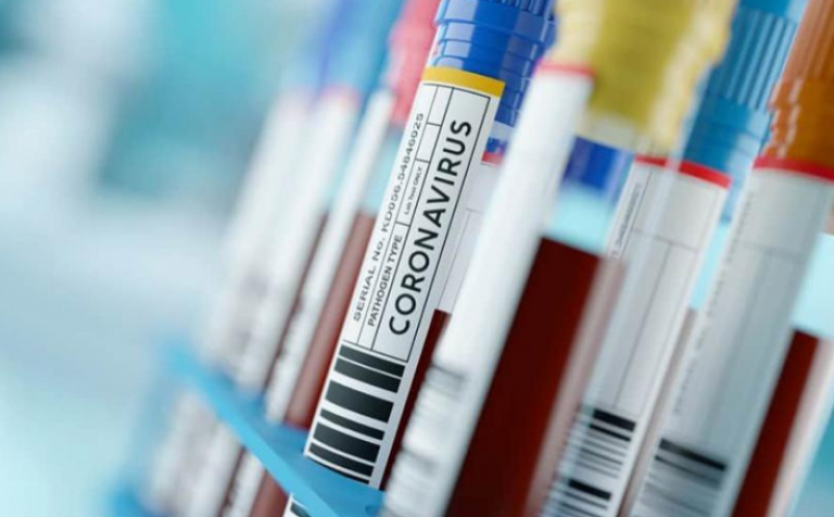 Изминатата недела за 37 % е намален бројот на заразени од Ковид-19