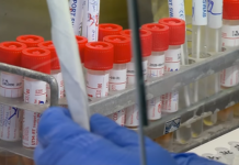 19 нови случаи на Ковид-19